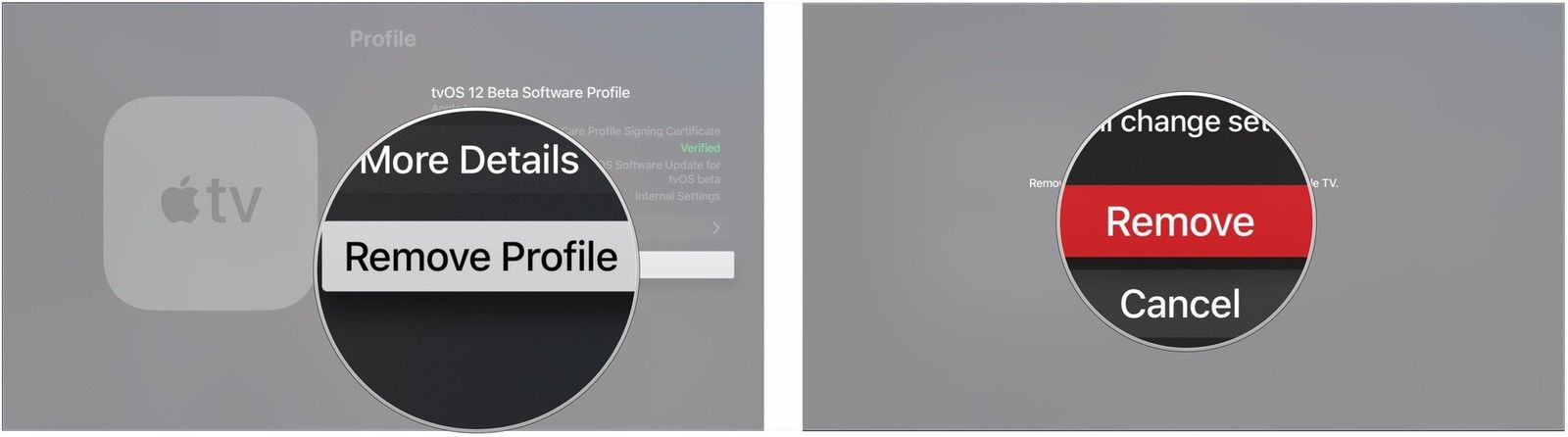 Нажмите Удалить профиль, нажмите Удалить