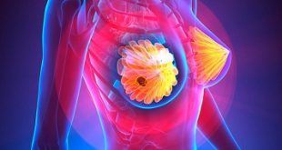 Как исправить Apple iPhone XR, который продолжает зависать и зависать после обновления iOS до версии 12.1.4 [Руководство по устранению неполадок] 1